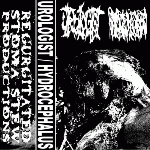 Urologist : Urologist - Hydrocephalus